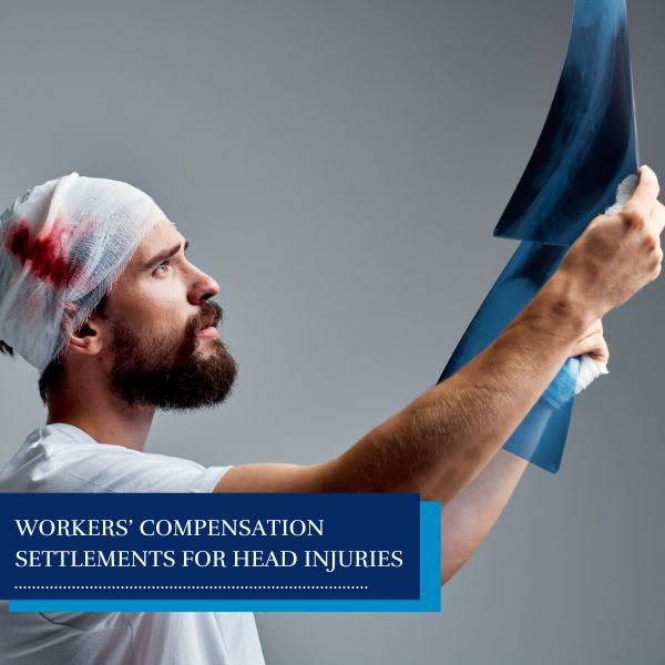 workers with a head injury - Workers’ Compensation Settlements for Head Injuries
